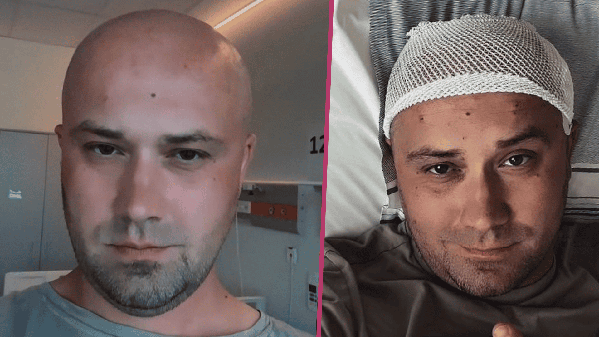 To były objawy guza mózgu. Gwiazdor TVN mówi, co go zaniepokoiło. Bardzo niepozorne