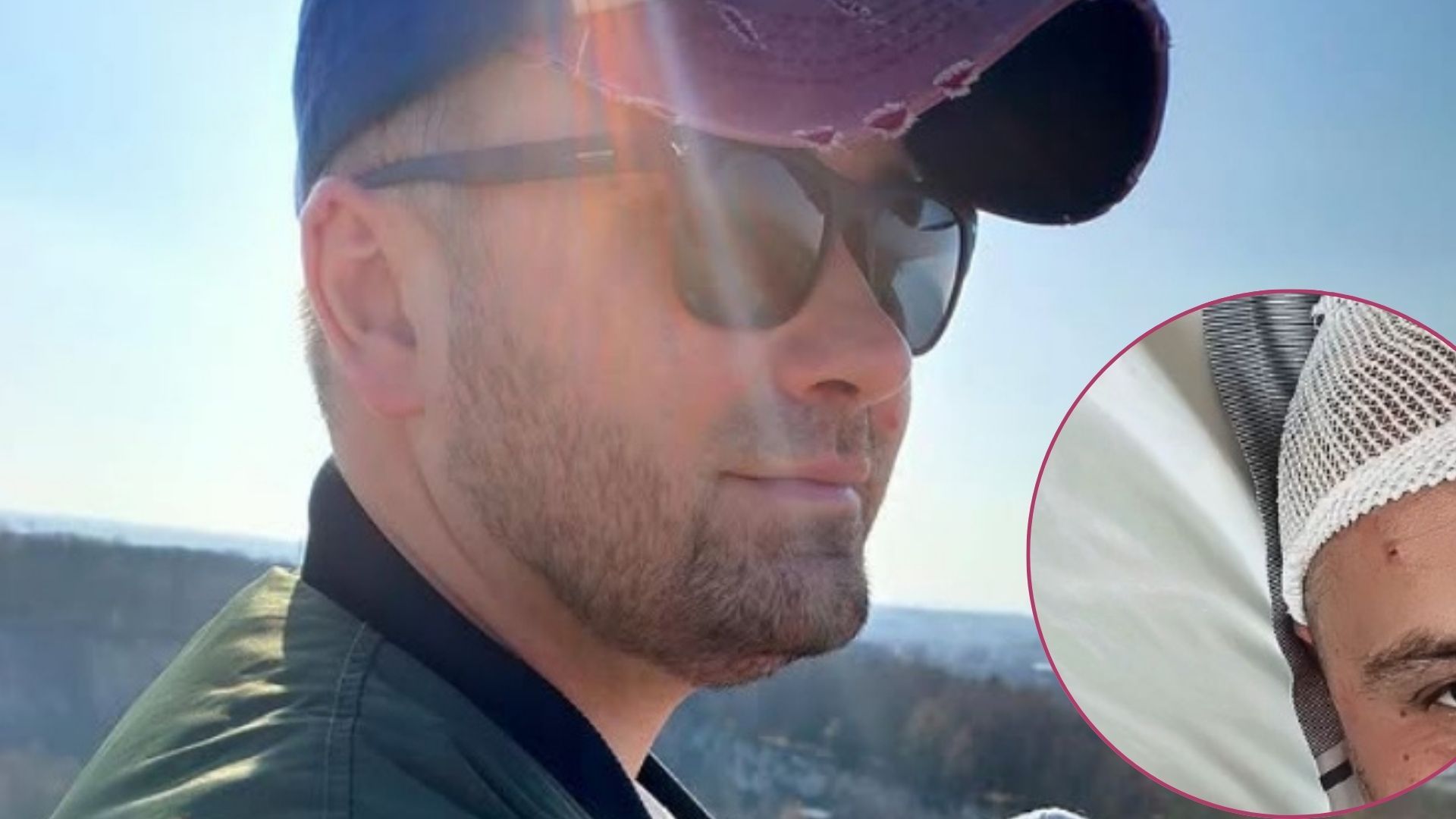 Gwiazda TVN przeszła operację mózgu. Są zdjęcia przed i po. Szokujący widok