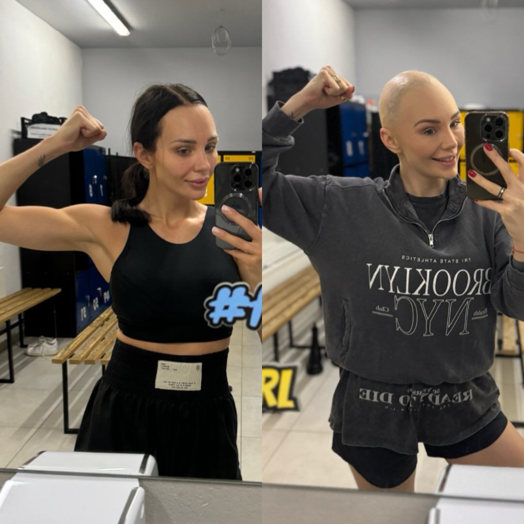 Gwiazda Polsatu przerwała milczenie ws. choroby. Pokazała wstrząsające zdjęcia