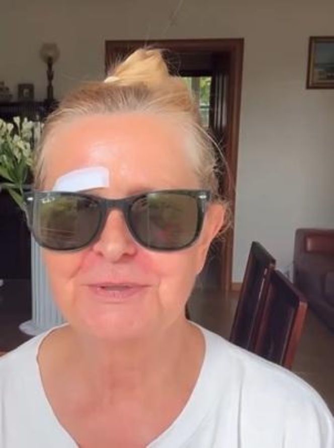 Barbara Bursztynowicz miała wypadek. Tak ją potraktowano. Aż przykro