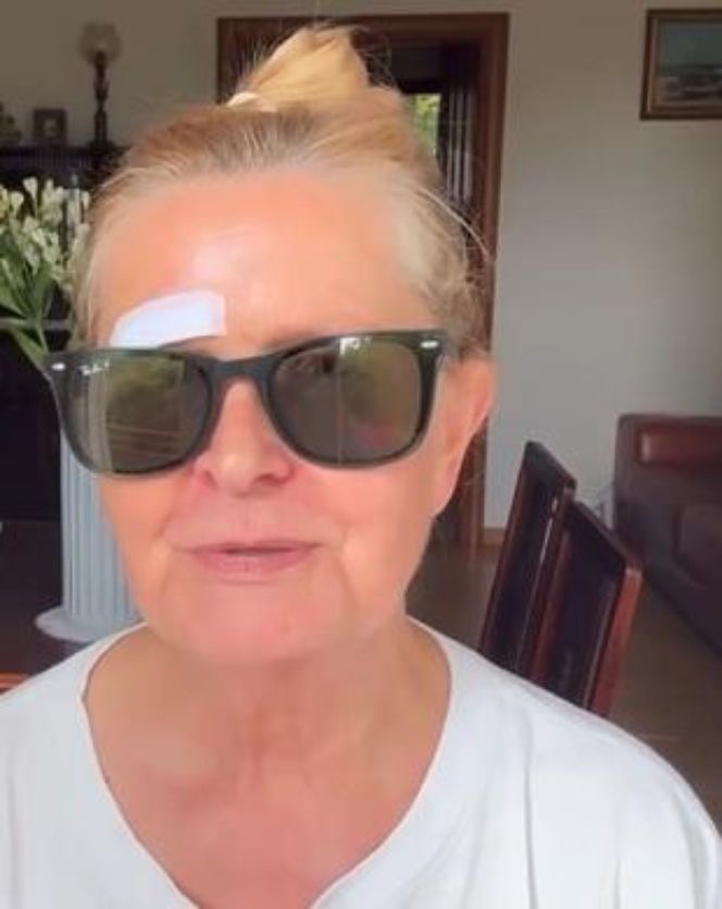Barbara Bursztynowicz miała wypadek. Tak ją potraktowano. Aż przykro