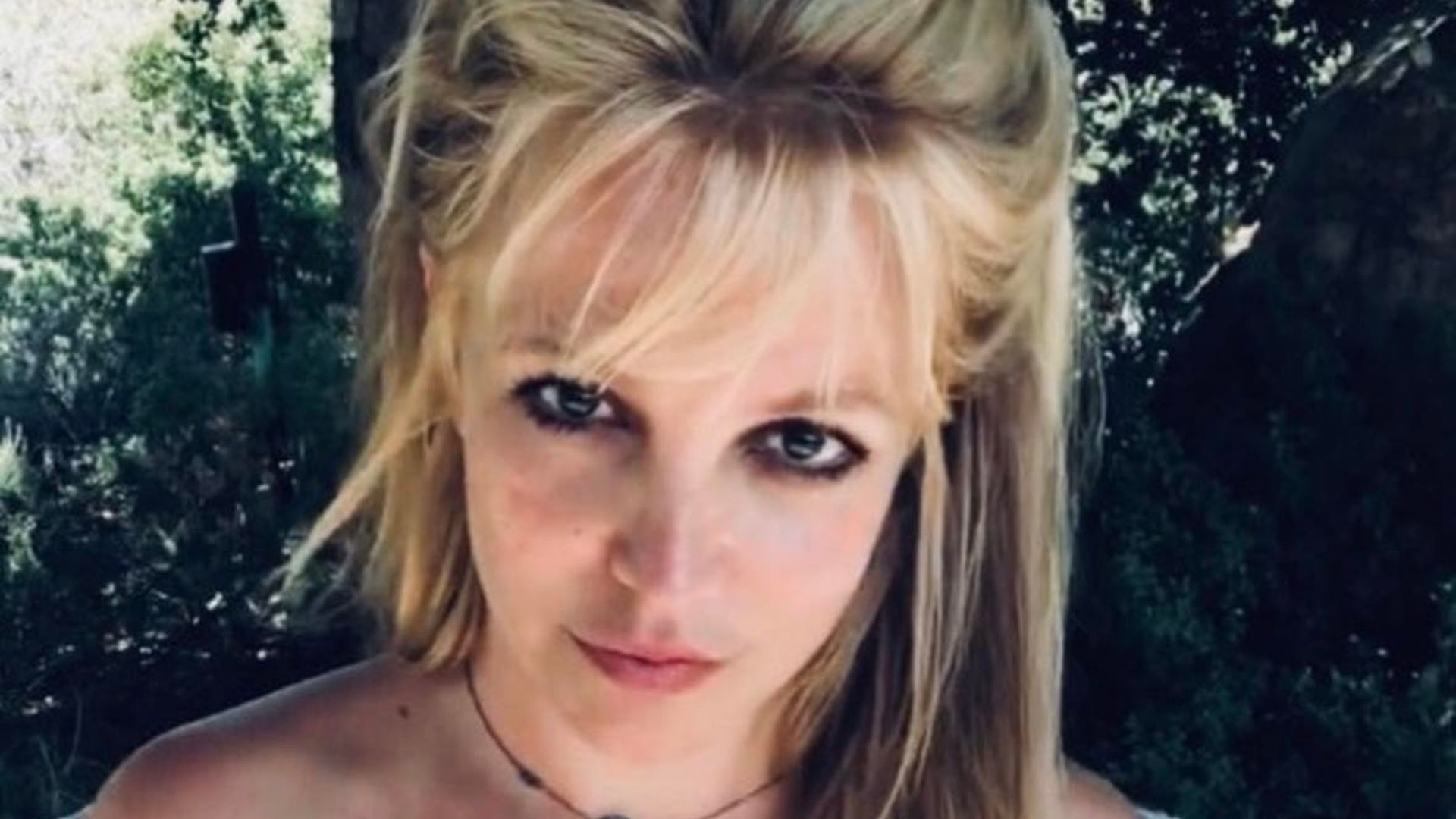 Britney Spears pokazała obrażenia po wypadku, fot. Instagram