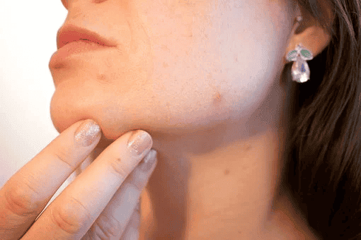 Wirusowe choroby skóry - jak uniknąć zakażenia?