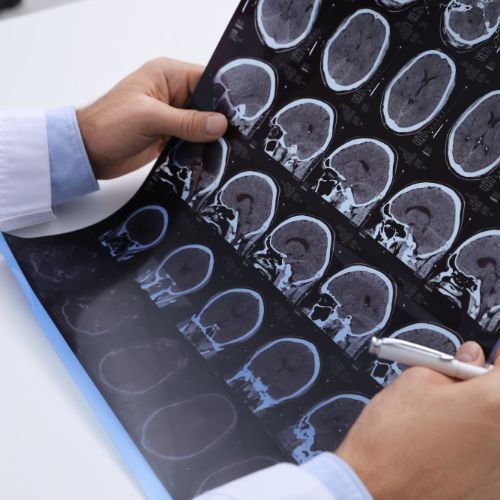 rezonans MRI mózgu stwardnienie rozsiane Fot. Africa Images/Canva.jpg