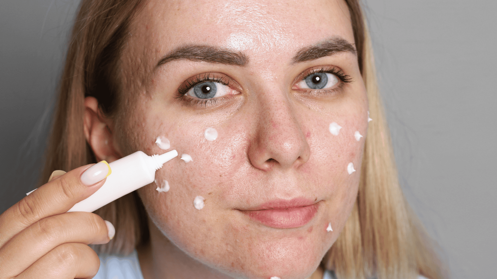 iastkujący się podkład, uczucie ściągnięcia i łuszczenie skóry