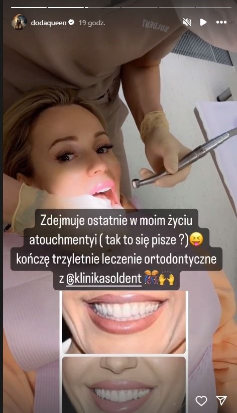Doda pokazała nowe zęby, fot. Instagram