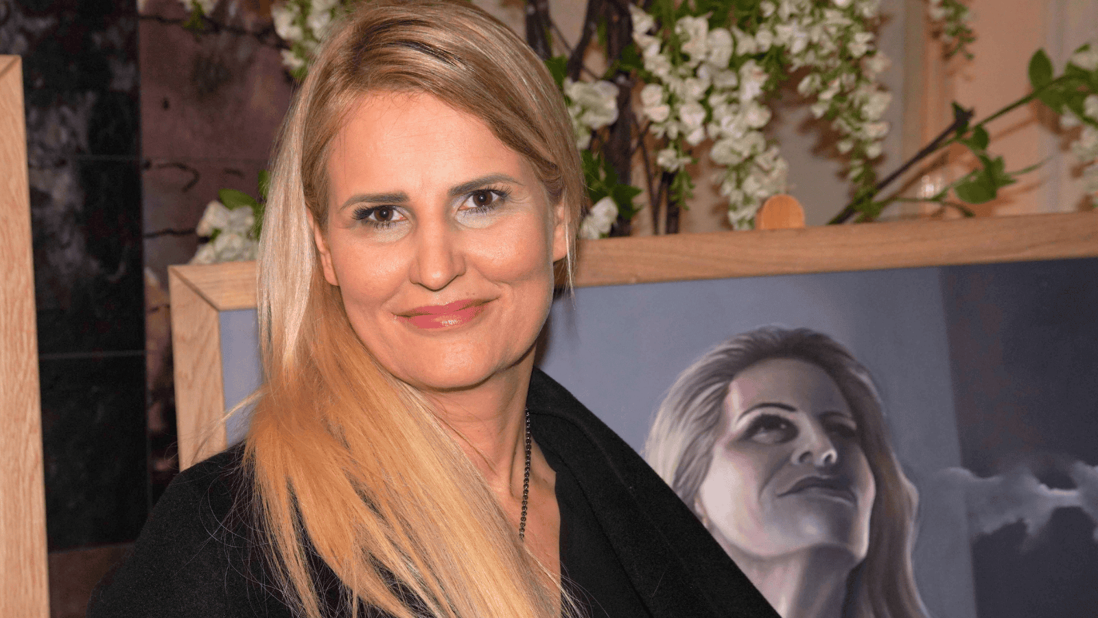 Dominika Tajner przeszła skomplikowaną operację plastyczną. Szczerze o trudach rekonwalescencji