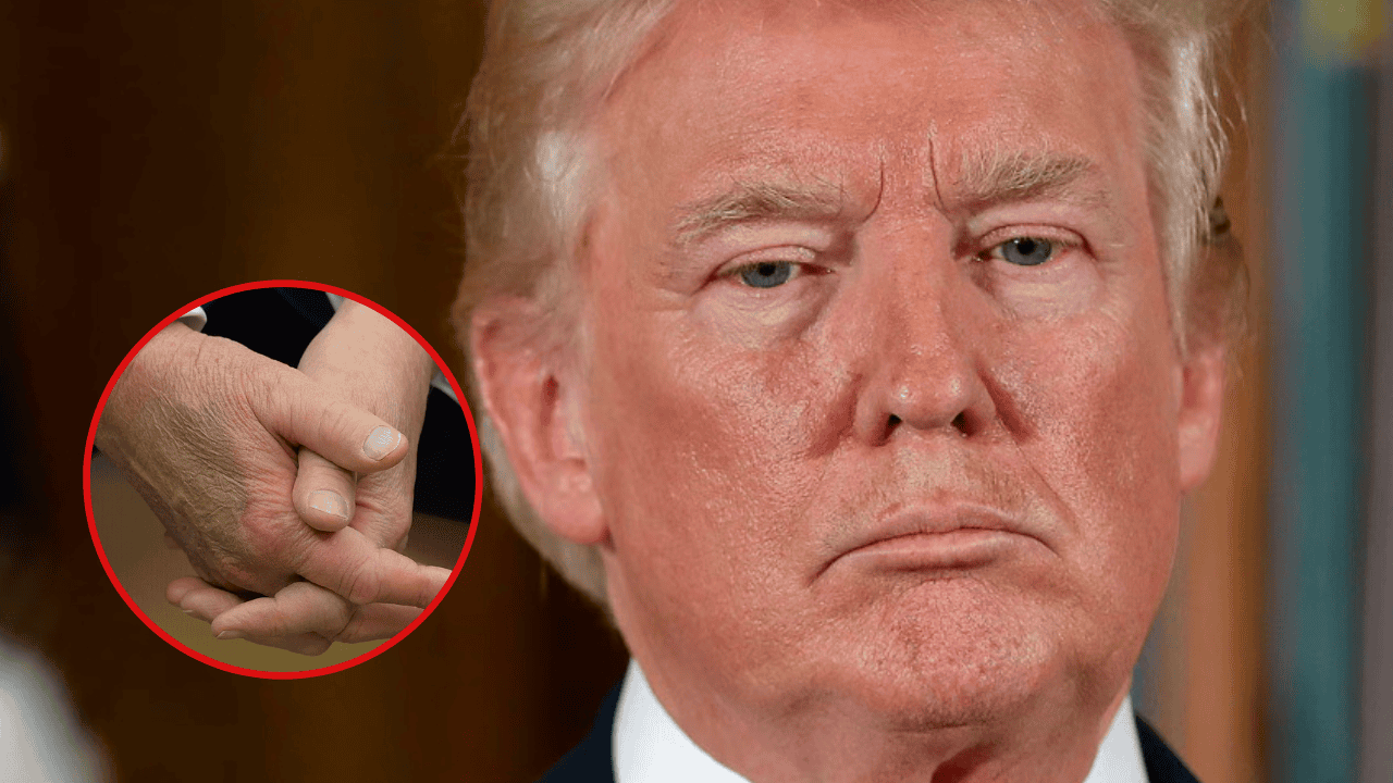 Donald Trump choroba