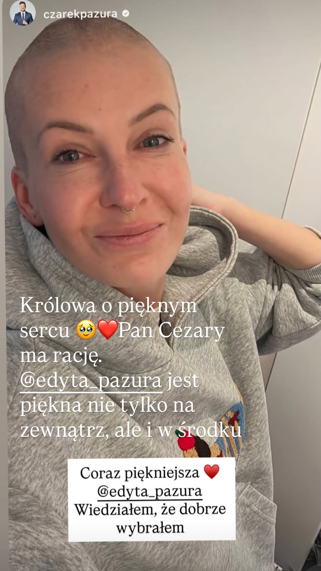 Te gwiazdy ogoliły głowę w zbiórce dla dzieci. Lista robi wrażenie. Mamy zdjęcia!