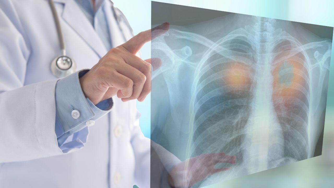 Niepozorna wysypka może być zwiastunem poważnej choroby. Nietypowe objawy raka płuc