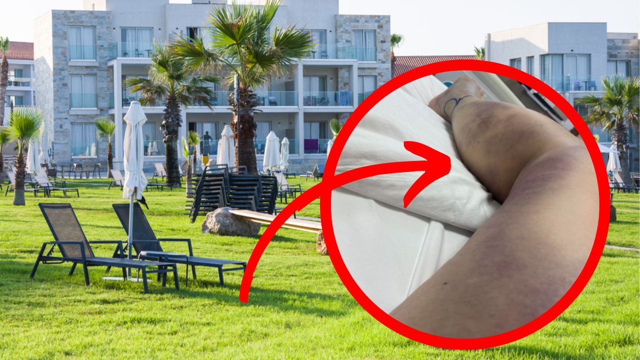 Zaatakował ją w hotelu na Cyprze. Turystka natychmiast trafiła do szpitala