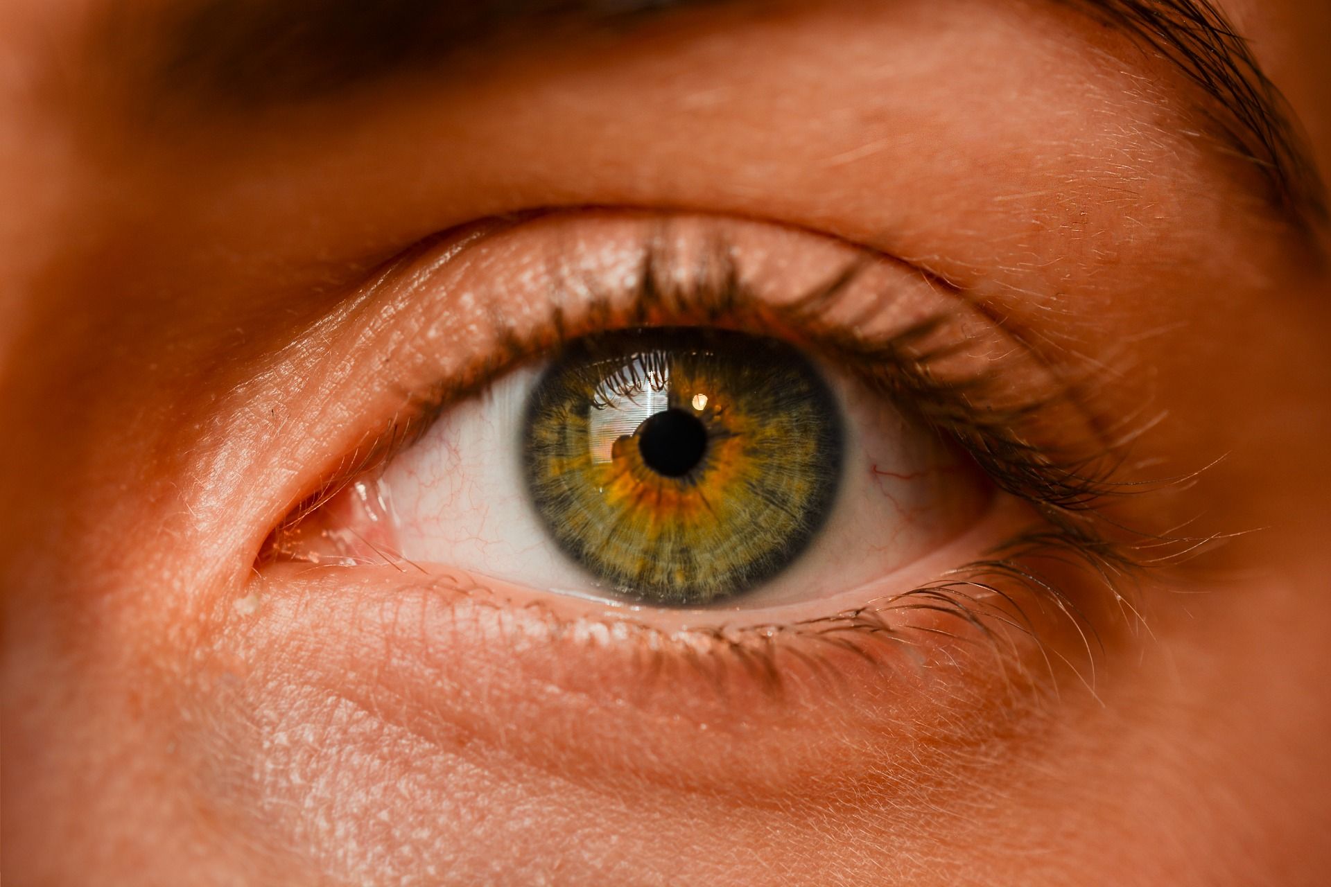 Pęknięta żyłka w oku – czy powinieneś się martwić?