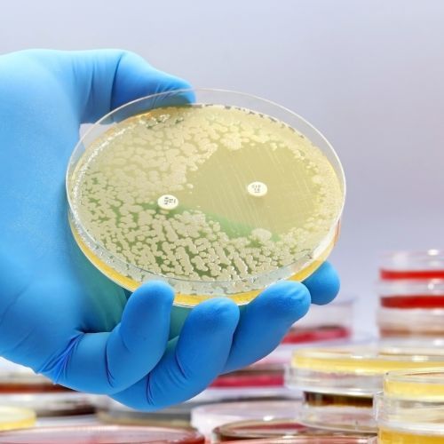 szalka petriego Fot. TopMicrobialStock/Getty Images.jpg