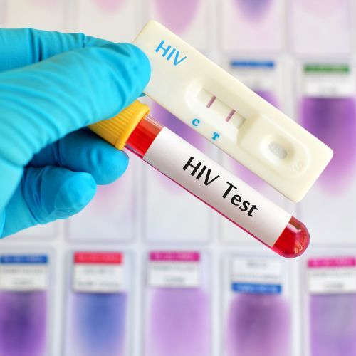 HIV-test.Canva