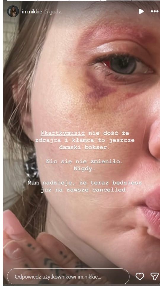 Horror partnerki polskiego rapera. Katował ją za zamkniętymi drzwiami. To nie wszystko