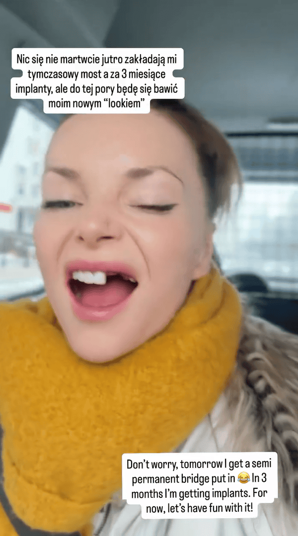 Znana gwiazda wybiła zęby! Miała wziąć udział w "Tańcu z Gwiazdami"