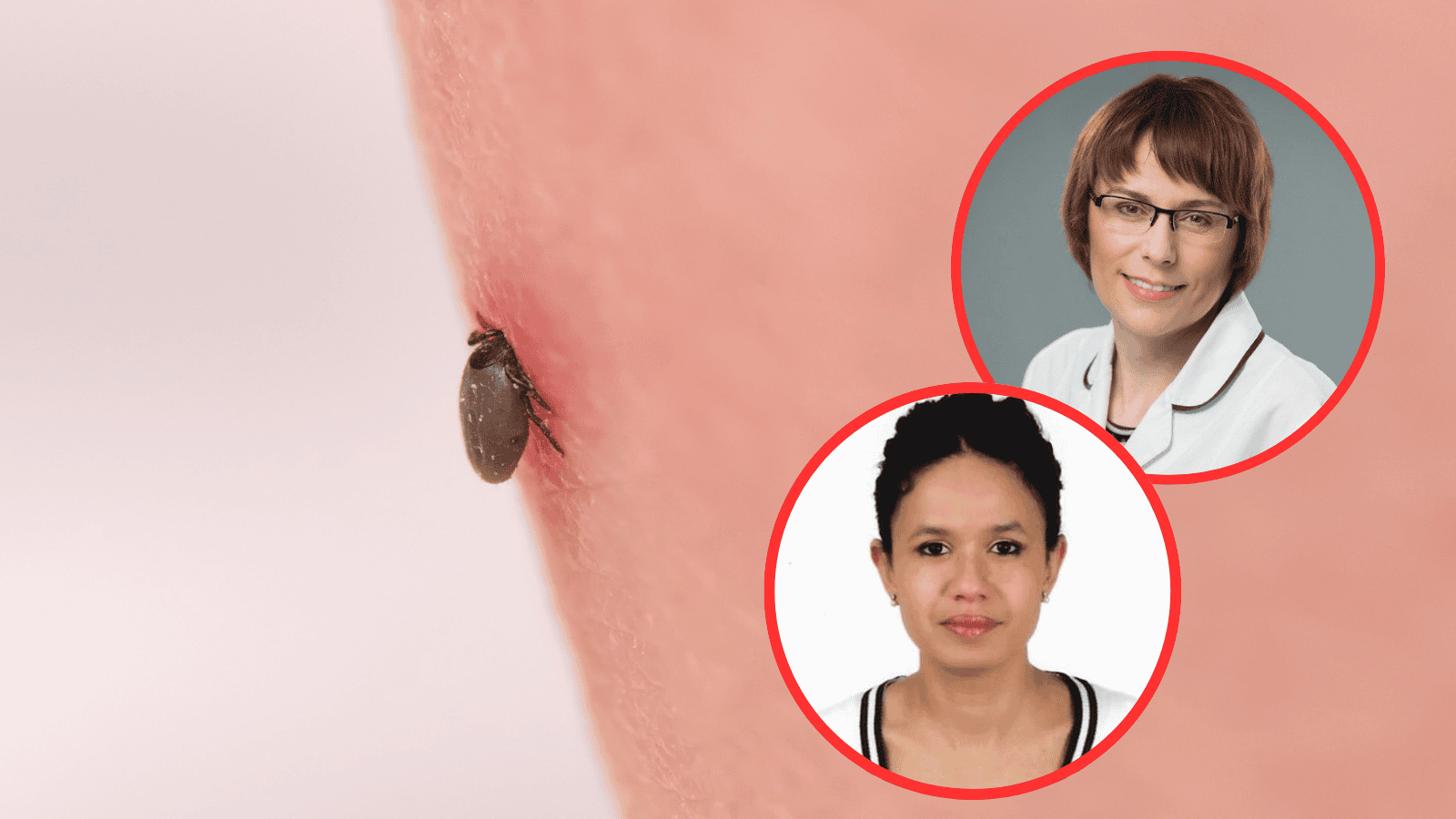 Zwykłe środki na kleszcze nie działają na nowy gatunek. Lekarze wskazują, jak uniknąć zakażenia