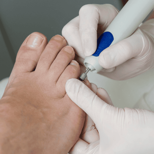 Leczniczy pedicure 2.png