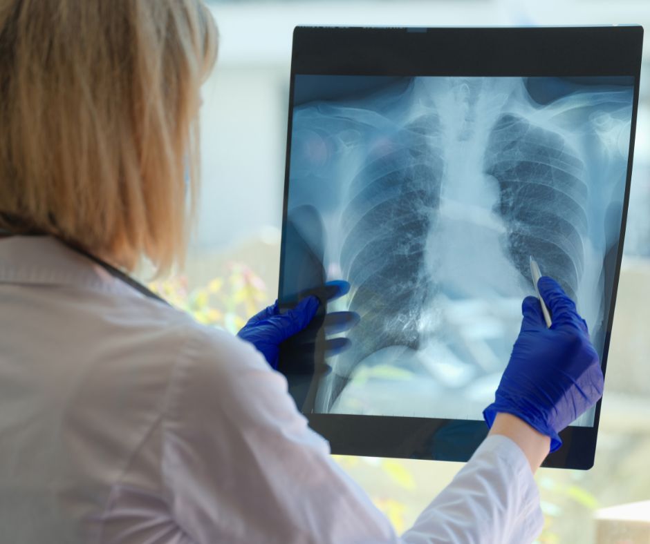 Lekarz sprawdzający zdjęcie płuc