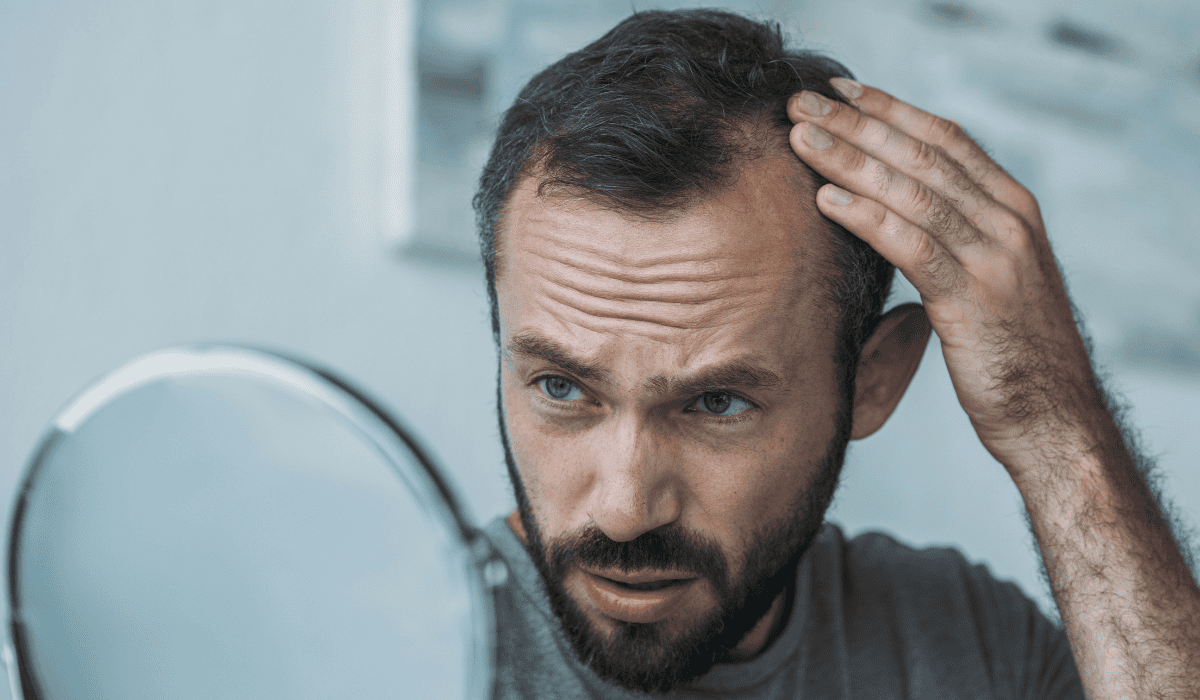 Zmagasz się z łysieniem po 40-tce? Poznaj metody na zakola