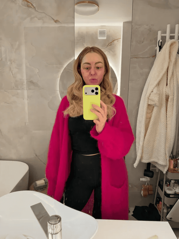 Po pożarze z trudem uszła z życiem. Niebywałe, z czym teraz musi się mierzyć. Koszmar gwiazdy sieci trwa