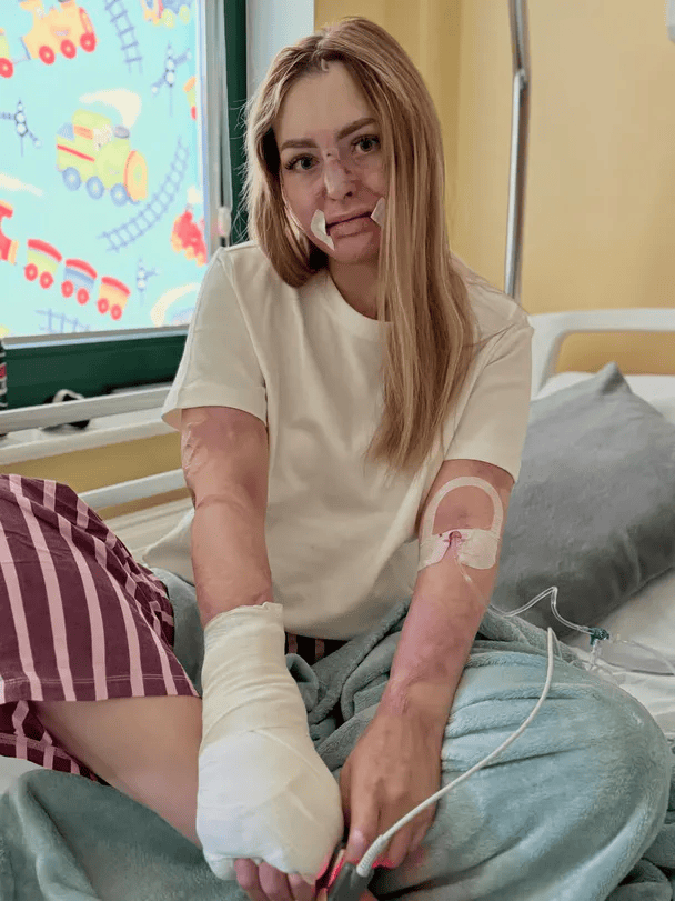 Po pożarze z trudem uszła z życiem. Niebywałe, z czym teraz musi się mierzyć. Koszmar gwiazdy sieci trwa