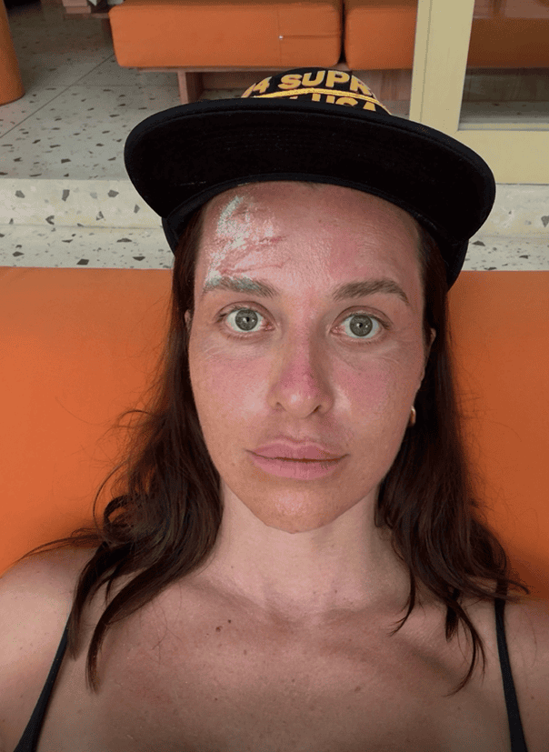 Znana aktorka wraca do zdrowia po wypadku na wakacjach