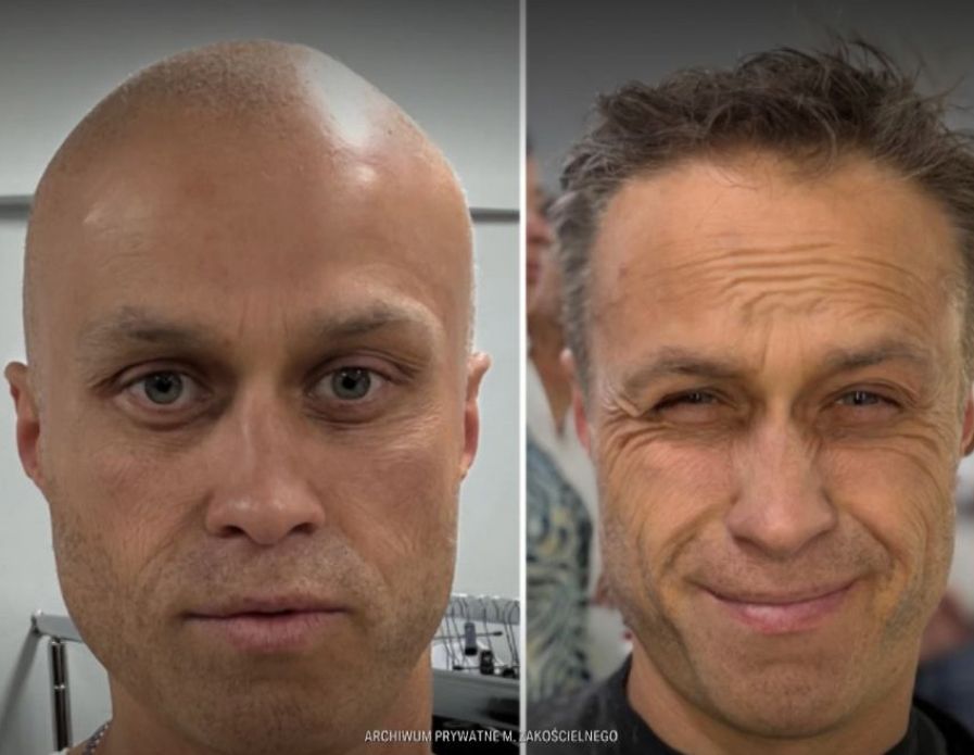 Drastyczna metamorfoza Zakościelnego. Po dawnym amancie nie ma śladu!