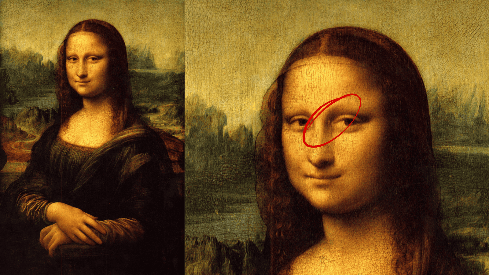 Masz takie zmiany na skórze? To znak, że cholesterol niszczy organizm [ZDJĘCIA]