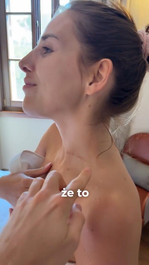 Wstrząsające nagranie! W weekend wzięli ślub marzeń, a tu takie wieści. Obrażenia na plecach i szyi
