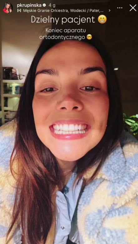 Krupińska otworzyła usta a tam... Zdjęcie zębów obiegło internet, media już się o nich rozpisują