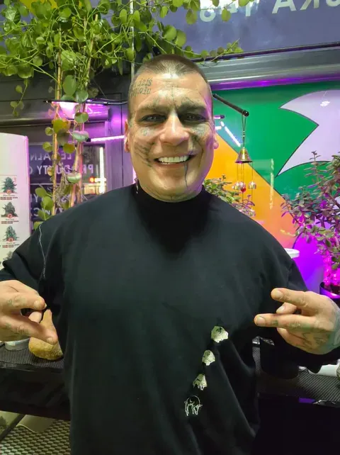 Metamorfoza uśmiechu Popka zaskoczyła fanów. Efekt wart zachodu?