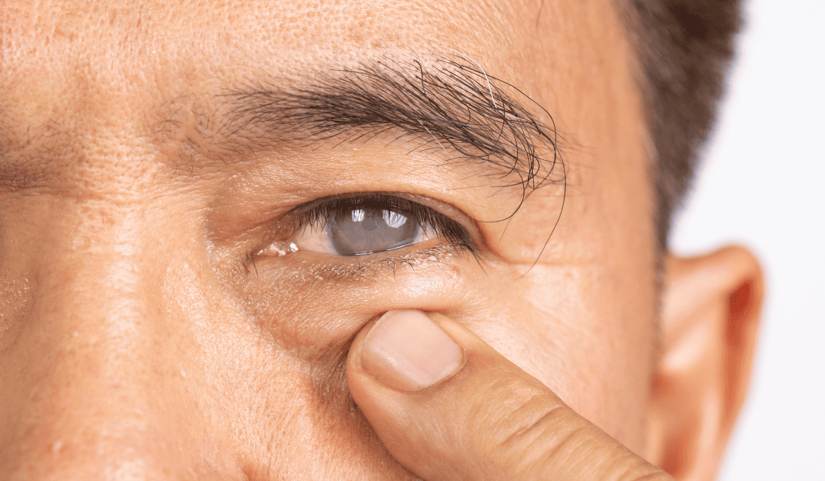 Ruszyły bezpłatne badania w kierunku jaskry. Jak znaleźć placówkę?