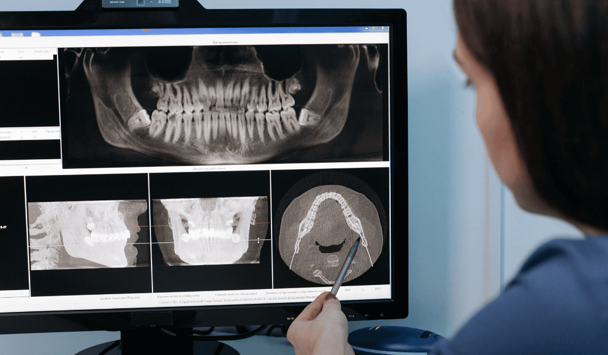 Przez zęby przestała chodzić. Tak szczęka wpływa na cały kręgosłup