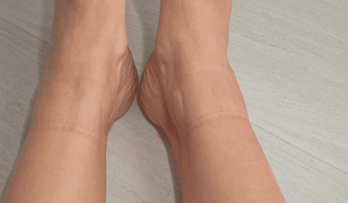 Odciśnięte skarpetki? Nie musi chodzić o ich rozmiar. Tak organizm daje ważny znak