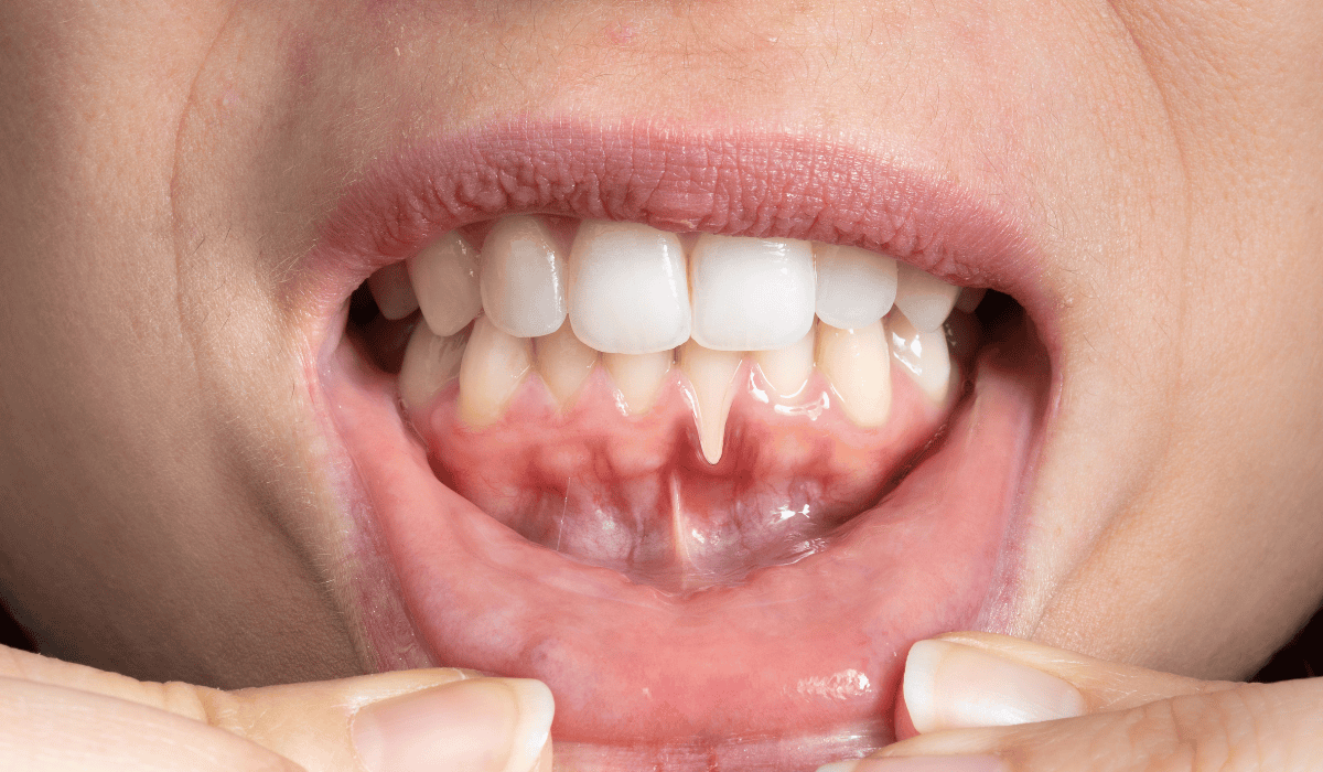 Stan zębów wpływa na cały organizm. Dentystka: "To nie tylko kwestia estetyki"