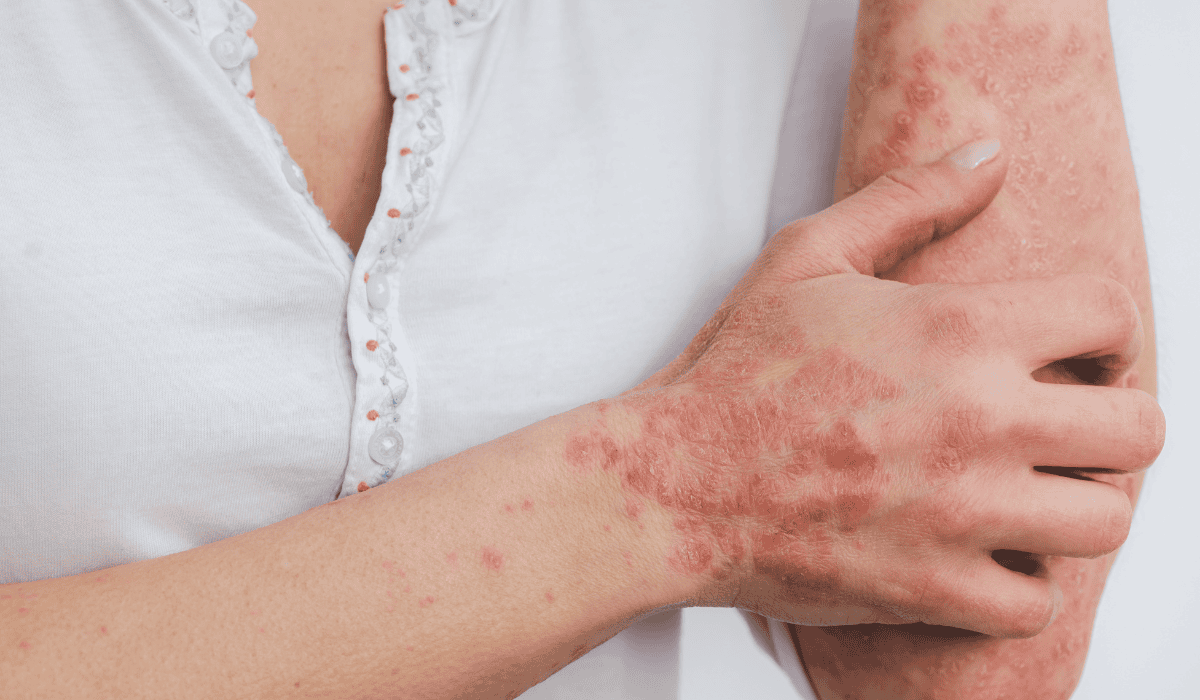 Cierpi na to od zawsze. Michał Wiśniewski szczerze o zmaganiach z chorobą