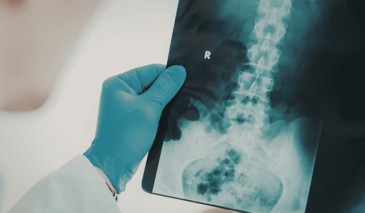 Ból pleców czy sygnał alarmowy? 5 subtelnych różnic, których nie wolno ignorować