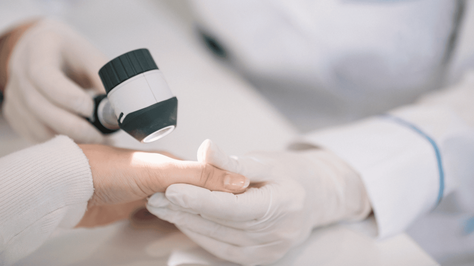 Dermatolog bije na alarm. Takie dłonie mogą oznaczać raka