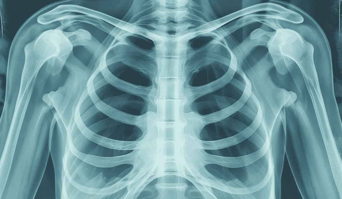 6 objawów raka płuca. Choroba potrafi ukrywać się latami