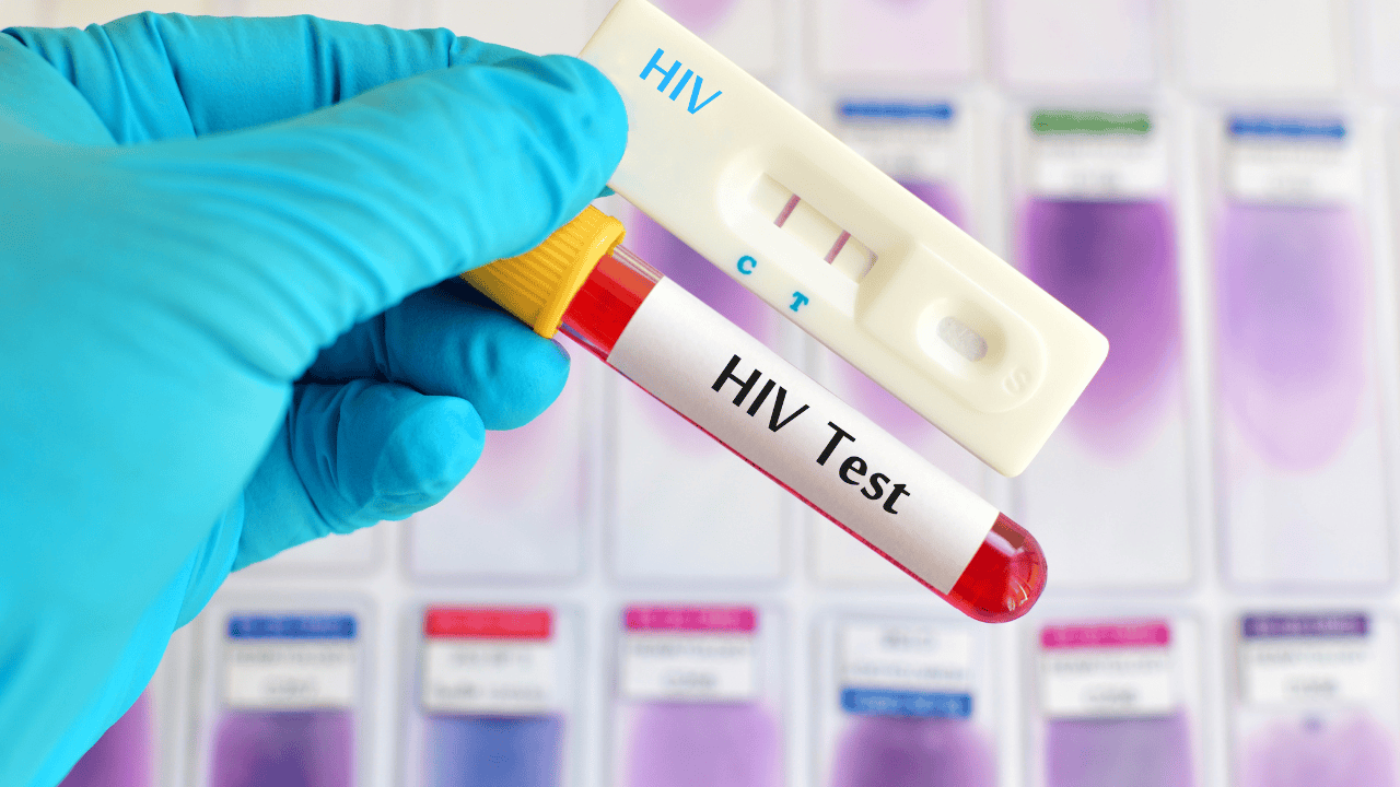 test na obecność HIV