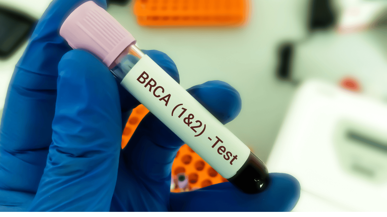  BRCA1