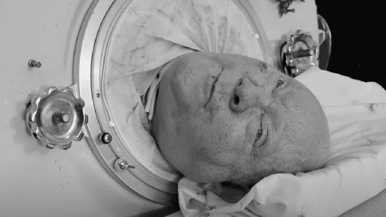 Przez 70 lat mieszkał w żelaznym płucu. Paul Alexander nie żyje
