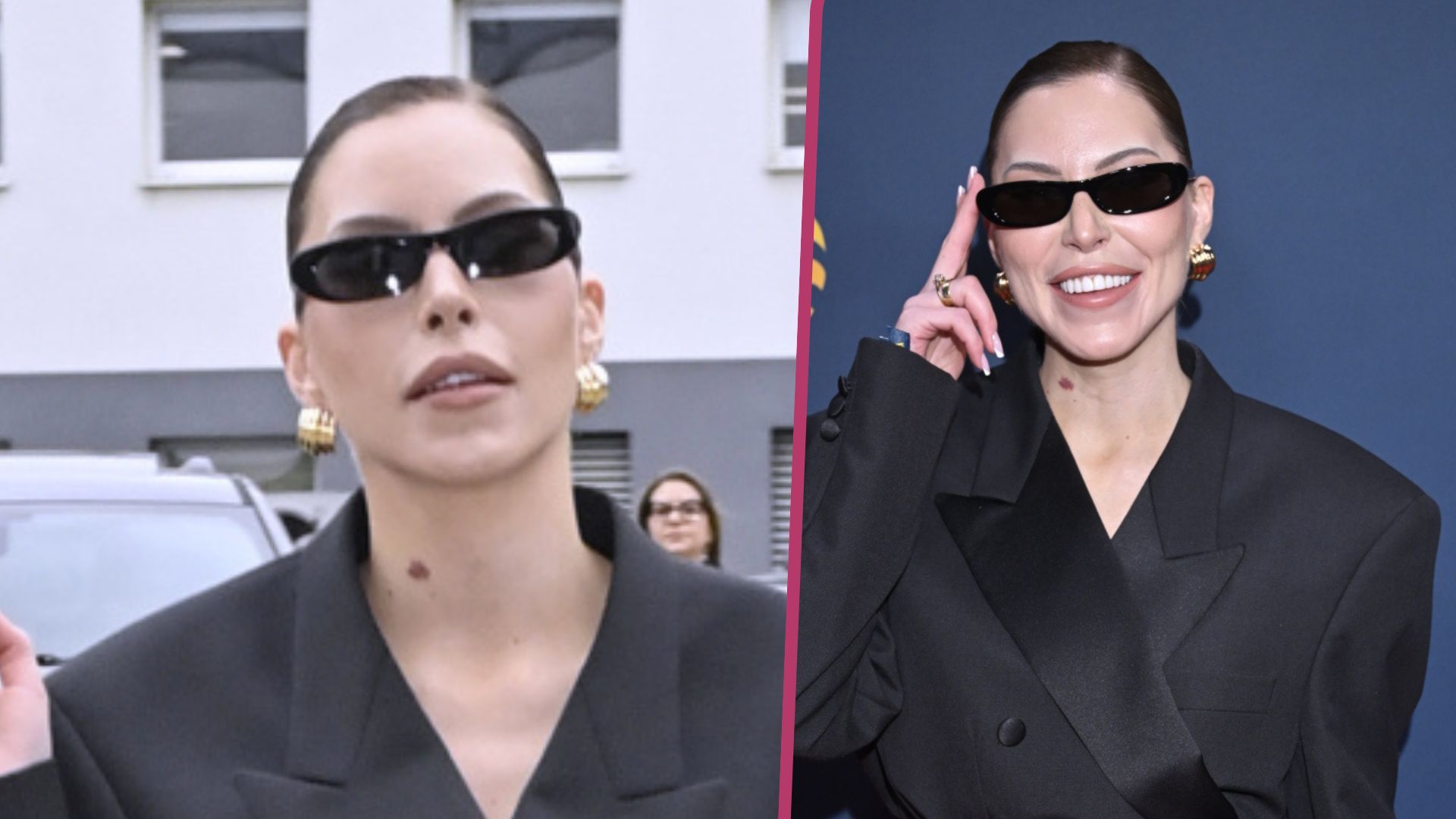 Gwiazda Polsatu na ramówce w samych pończochach i z nową twarzą. Tak wygląda po operacji plastycznej