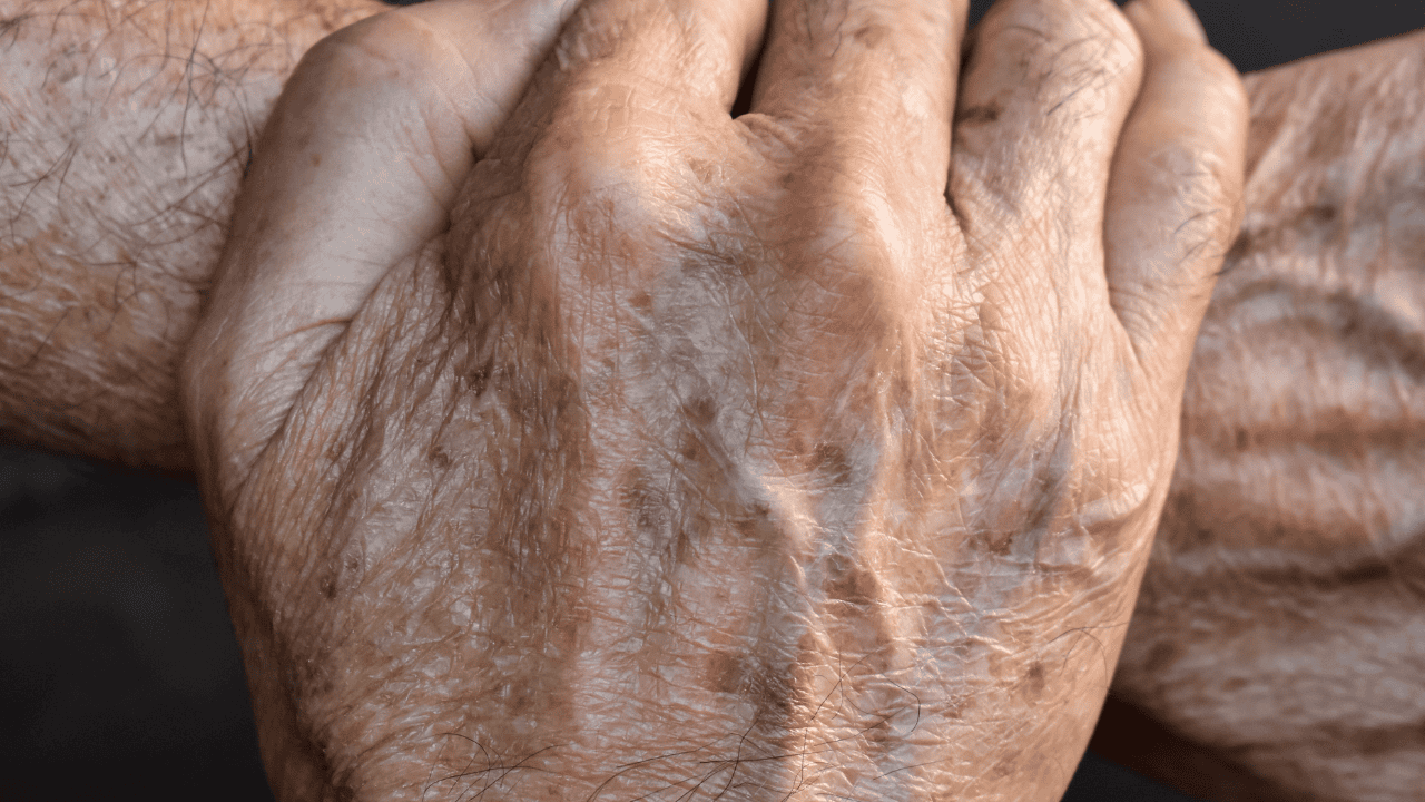 Krem do rąk a plamki starcze: jak działa i na co pomaga