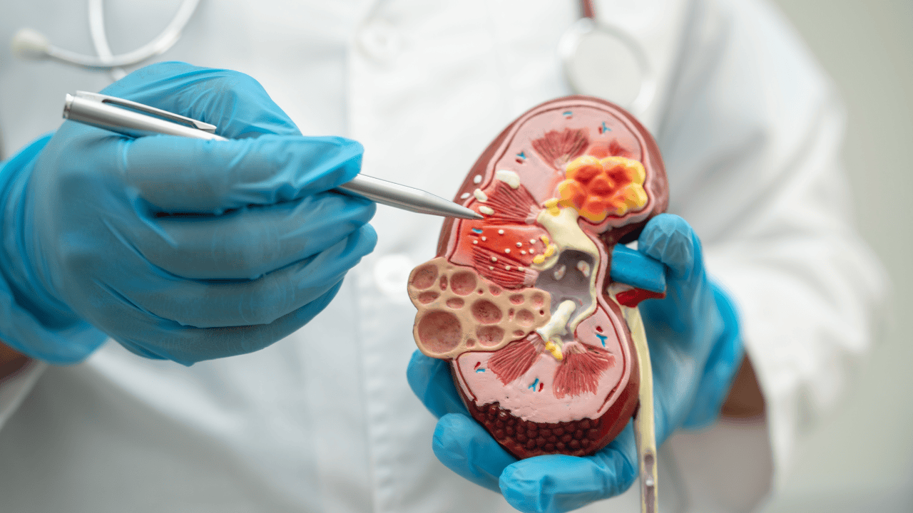 Przewlekła choroba nerek. Cichy wróg, który często nie daje objawów