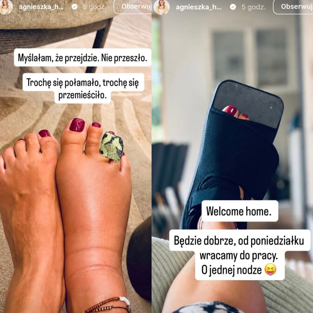 Jak ona pójdzie do pracy? Agnieszka Hyży pokazała, co ją spotkało na wakacjach