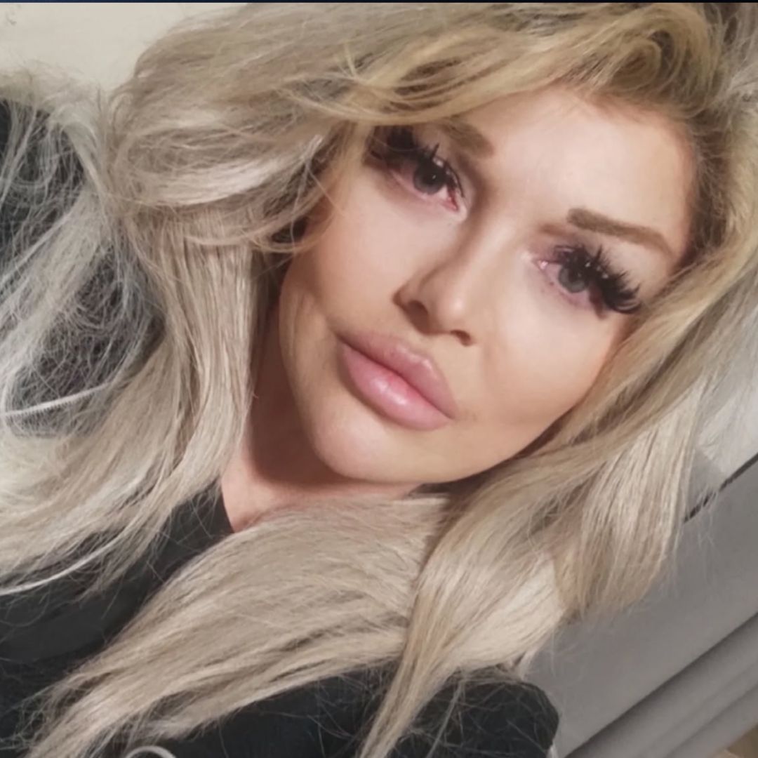 Polska aktorka walczy z nieuleczalną chorobą. Porównywano ją do Pameli Anderson