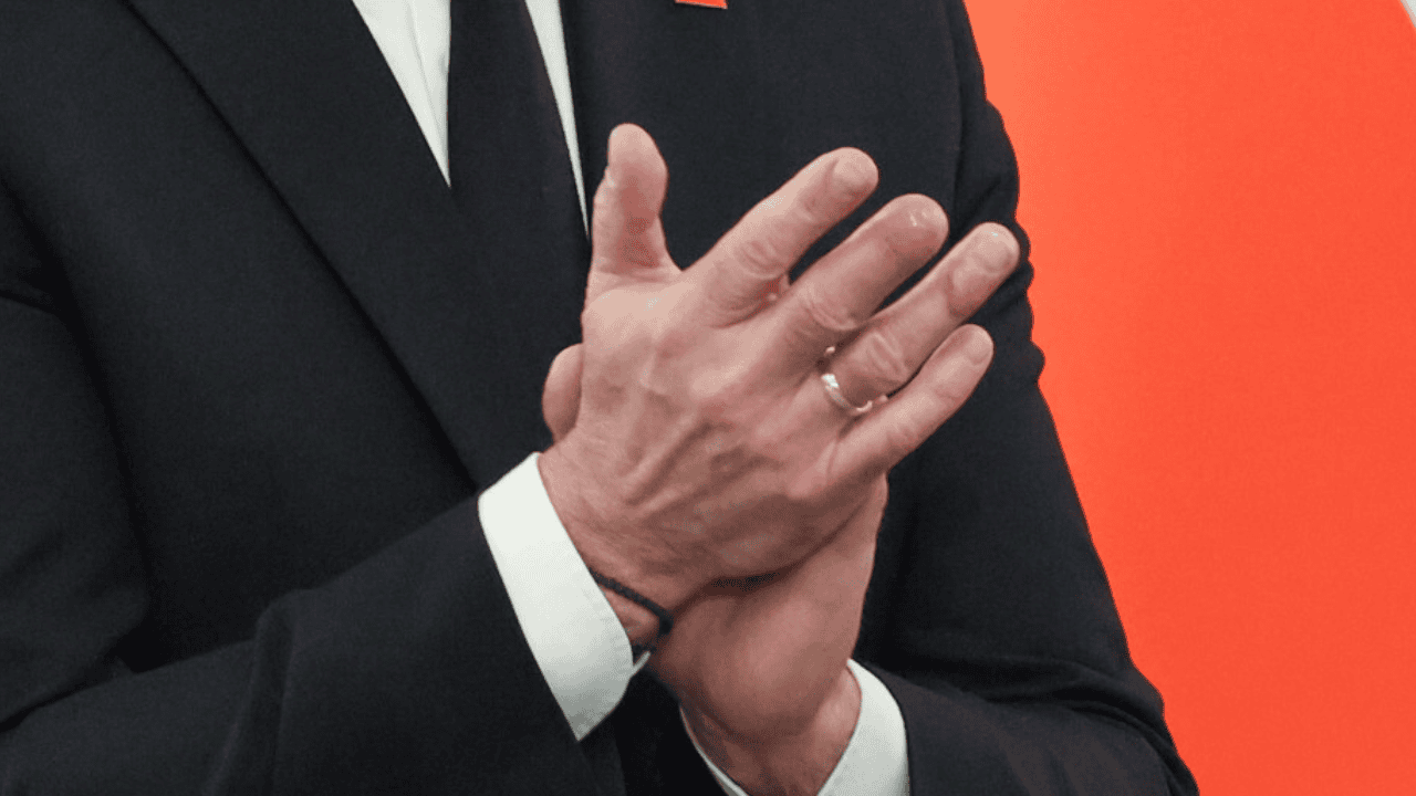 Andrzej Duda stracił kawałek palca. Przyznał się, jak do tego doszło