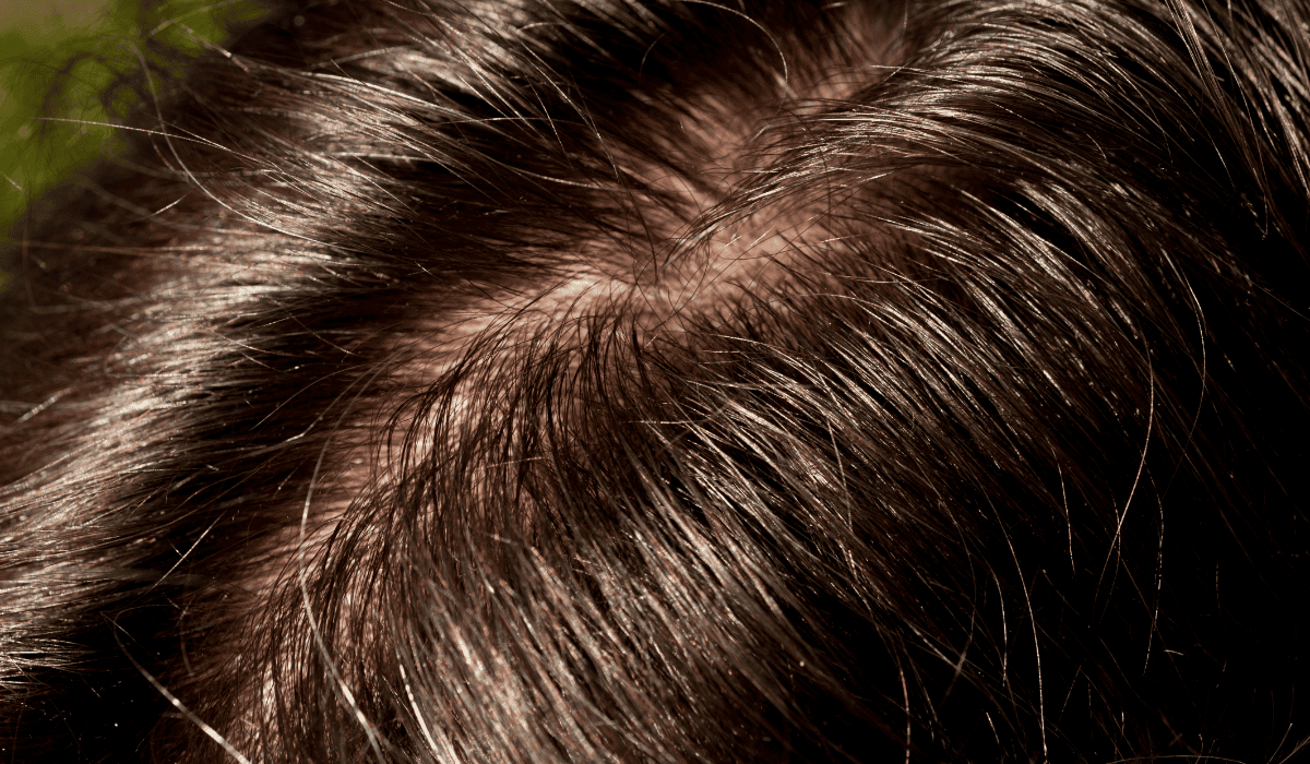 Przetłuszczające się włosy (2).png